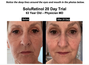 SoluRetinol